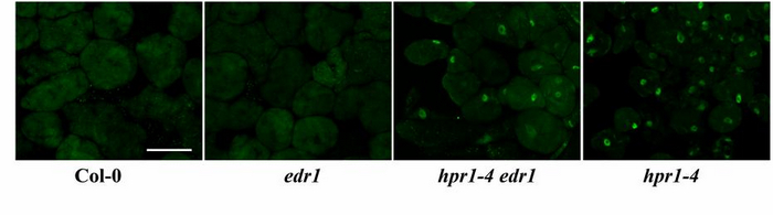HPR1 Is Required for Immune Response in Arabidopsis