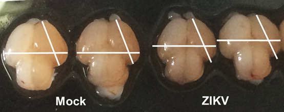 Fetal Mice with Zika Infection Get Microcephaly