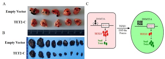 IGDB Scientists Discovered the Molecular Mechanism of Cancel Cell Metastasis in Melanoma