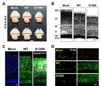 Chinese Scientists Uncover the Critical Neurovirulence Determinant of Zika Virus Contributing to Fetal Microcephaly