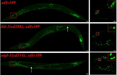 Lipid Droplet Dynamics in Neurons Regulates Neurodegeneration