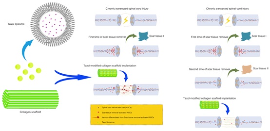 Scar Tissue Removal activated Endogenous Neural Stem Cells