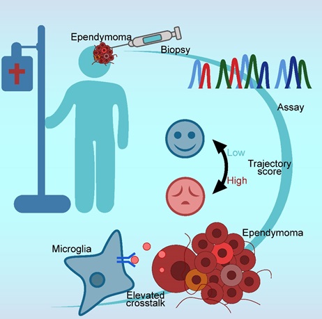 Elevated Crosstalk between Immune and Tumor Cells in Relapsed Ependymoma