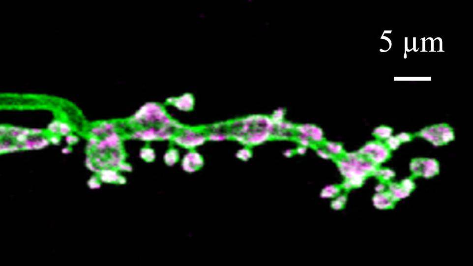 Scientists Reveal a Novel Regulatory Mechanism of Protein Homeostasis in Synapse Development