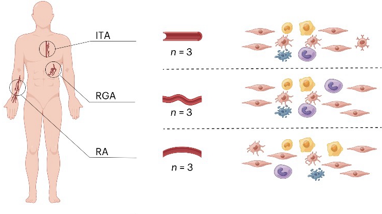 Researchers Revealed the Molecular Mechanisms of Different Donor Arteries for Coronary Artery Bypass Grafting